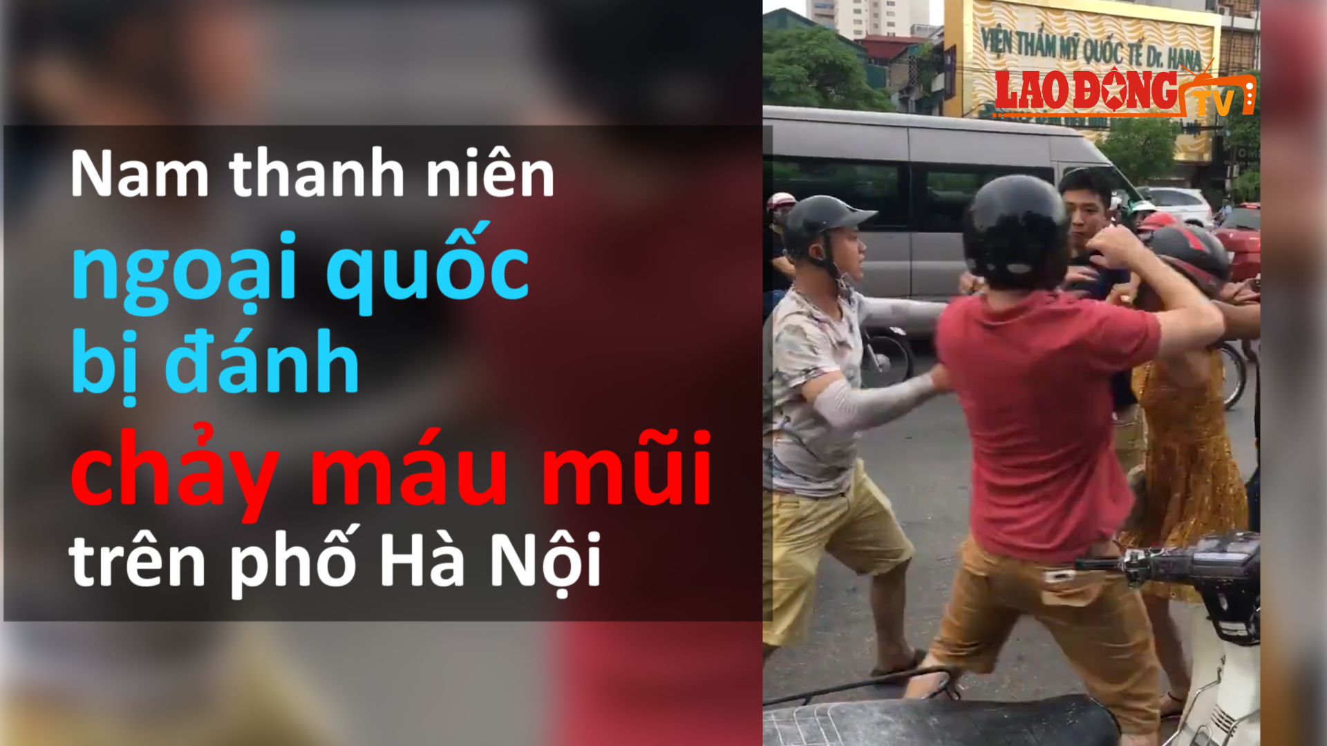 Infographic: Từ vụ nam thanh niên ngoại quốc bị đánh chảy máu mũi trên phố Hà Nội và văn hóa ứng xử của một bộ phận người Việt